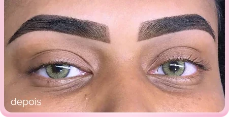 Sobrancelhas depois da BrowFusion